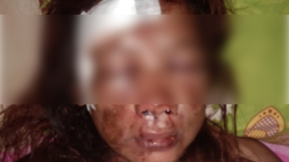 Pasien Susianti Diduga Diterlantarkan oleh UGD – BLUD RS Kabupaten Konawe, Aktivis HMI MPO Desak Bupati Copot Kepala RSUD
